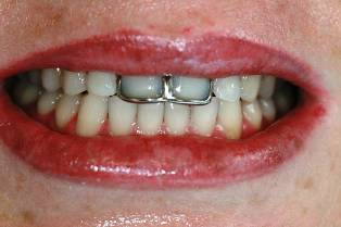 Before Image