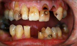 Before Image