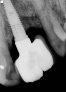X-Ray Image