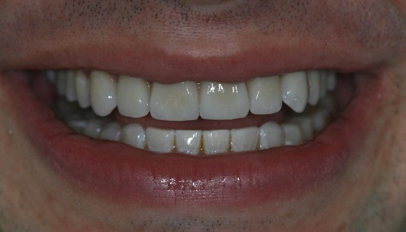 After