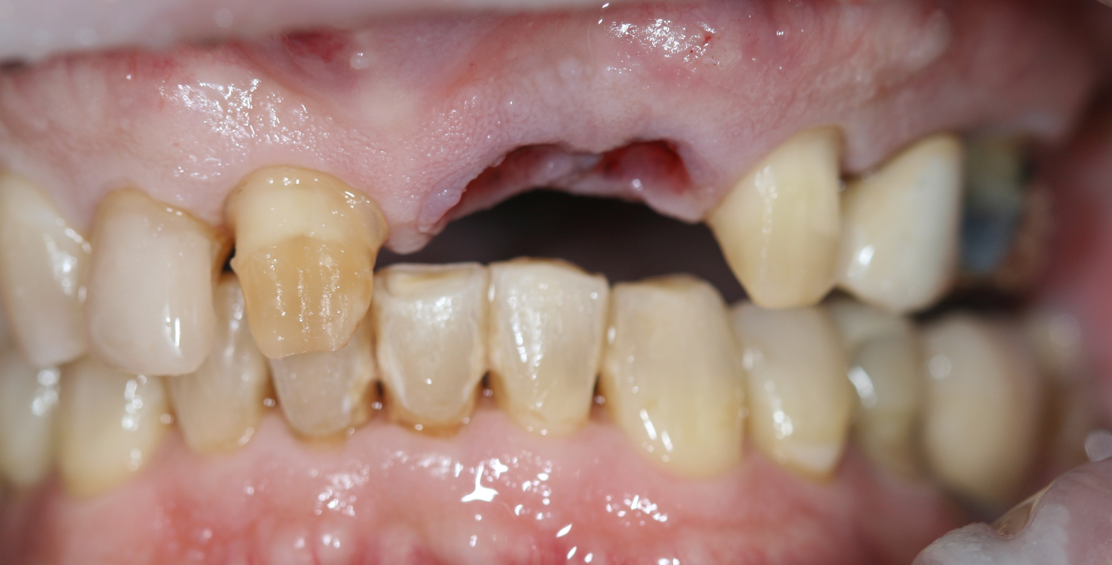 Before