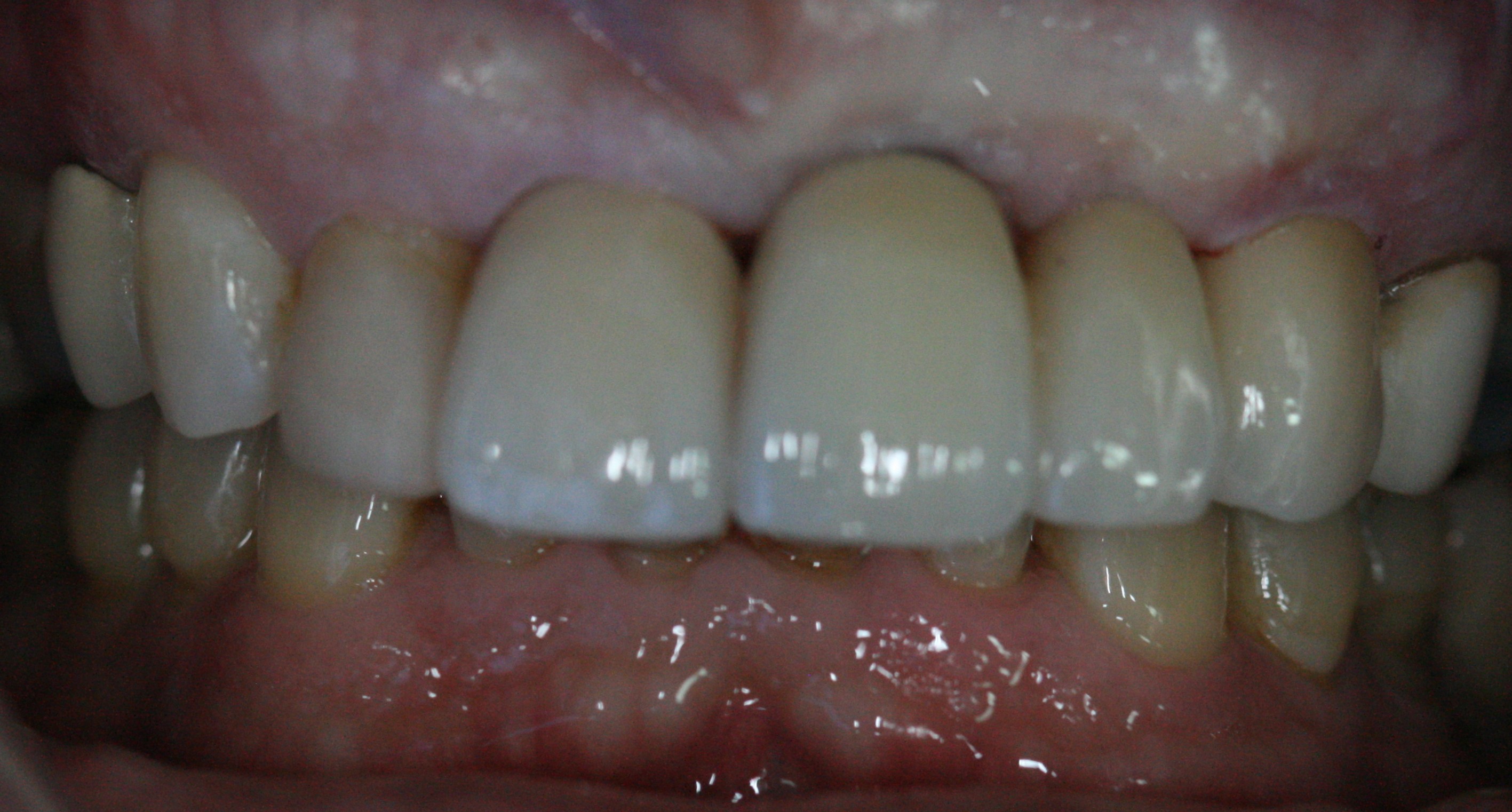 After