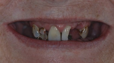 Before